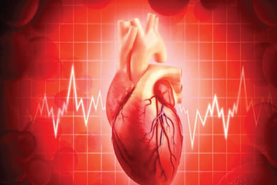 Electrocardiogram